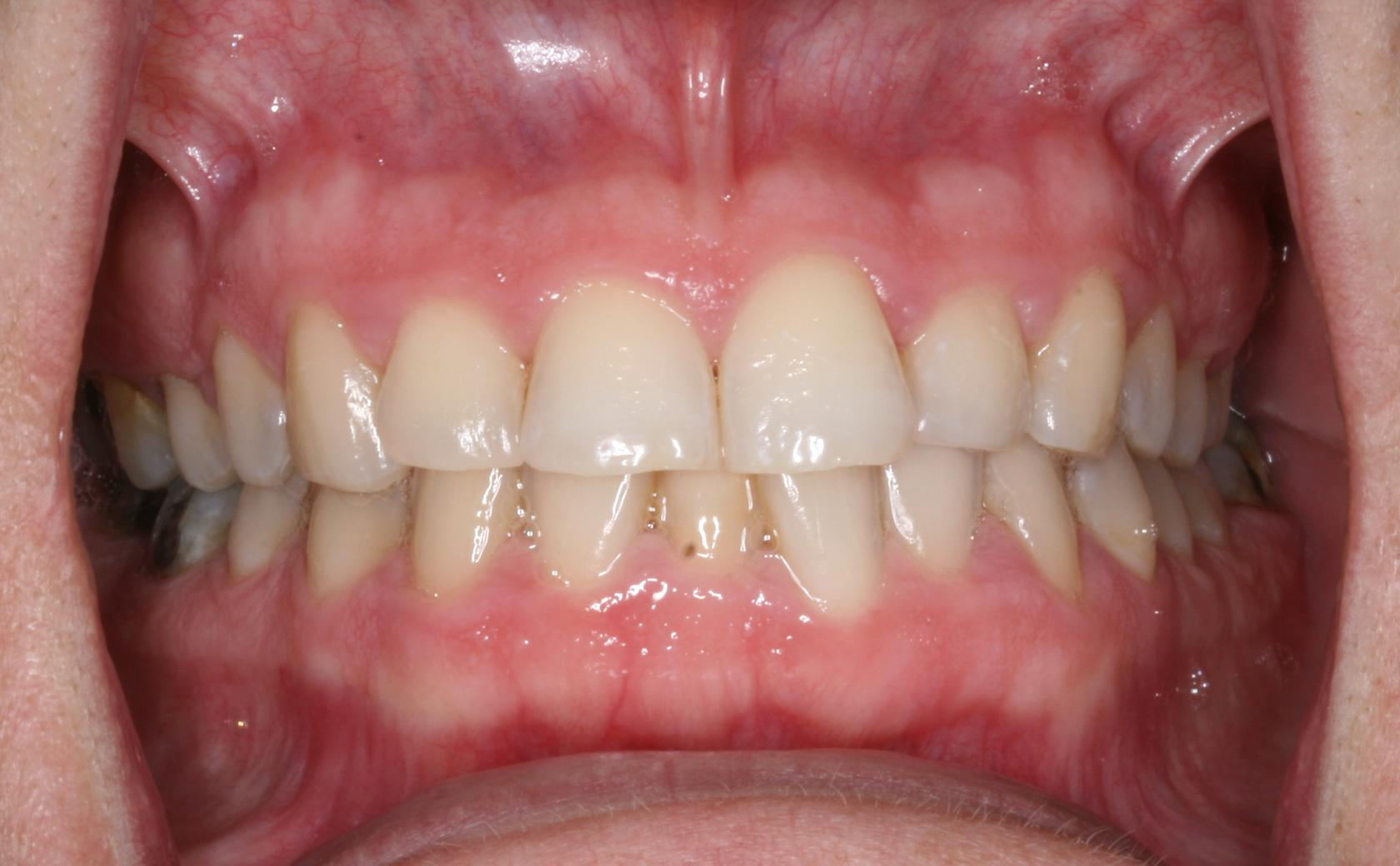 AboutMe banner for @tooth