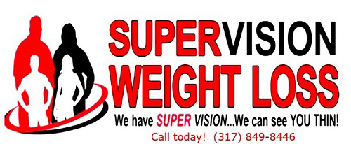 AboutMe banner for @supervision
